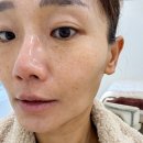 더윰:테라피