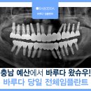 미주치과의원 | 겨~충남 예산에서 바루다! 바루다! 소개받고 왔슈우_너무 심한 치주염으로 교합까지 무너진 50대의 전체...