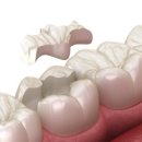 저스트치과기공소 이미지