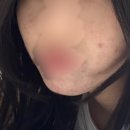 한의원에서 아랫배 빼는 법 알아낸 다이어트 후기!