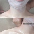 스킨스토리(story) 이미지