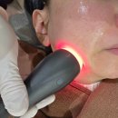 이브이야기 | 잠실새내역피부과 이브타이탄 풀패키지 받은 후기