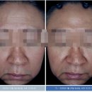 야누스 - 통영시 통영해안로 367 | 압구정 피부관리, 타고난 꿀피부인 줄 알았는데 대충격 😱! 우리 한의원 야누스 피부진단기 찐 후기 ✨