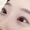 글루테라피
