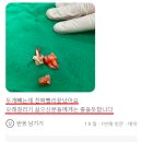 가산디지털단지 사랑니 발치 - 발치 시 통증이 걱정되시나요? &lt; 구강악안면외과 전문의 칼럼 &gt;