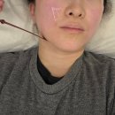 황후에스테틱 | 포항 윤곽관리 명성황후 에스테틱 알테온 후기