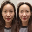 달리아에스테틱(부산서면점) | 서면윤곽관리 제대로 찾았다｜서면신부관리 필수 코스, 달리아에스테틱 부산서면점 후기