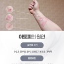 세제한의원 티스토리