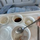더웰병원 | 수원 영통 더웰병원 편도절제 코블레이터수술후기