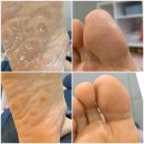 아우룸네일 이미지