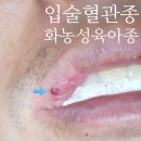 유디트의원 네이버블로그