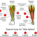 Re:과사용증후군 - shin splints 이미지