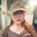 여성의집 | 30대 여성의 얼굴실리프팅 최초 솔직후기 홍대피부과 원더트리플 팔자주름 없애기 붓기, 멍