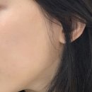 임성개발주 | 집에서 주름 없애는 법 탄력 뷰티기기 홈쎄라 효과 부작용