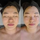 위례 에스테틱 - 위례 신부관리로 유명한 &#39;디유 에스테틱 위례점&#39;에서 글로우핏 리프팅 관리 후기