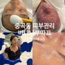 광진바른약국 | 중곡동 군자역 피부관리, 바나나부띠끄