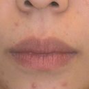 최종원한의원 이미지