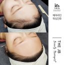 모들헤어