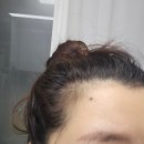 청소년 탈모 추천 닥터토비아 헤어 인헨싱 폼 솔직 사용후기