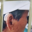 대구소리샘보청기 이미지
