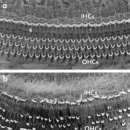독일보청기 난청센터 이미지