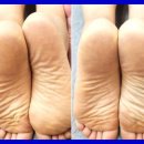 바른체형수기센터안마원 네이버블로그