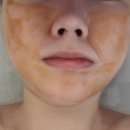 온예라에스테틱 | 야탑피부관리 온예라에스테틱 연예인필 후기