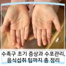 수족구 초기 증상과 수포관리, 완치시기 | 음식섭취 팁까지 총 정리
