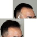 새로이헤어