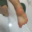 (주)세라젬 NC해운대점 | 부산 해운대 장산역 패디플래닝 여름대비 발각질관리 슈가윤뷰티