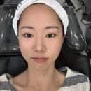 고고스킨 | 미금역피부과 시너젯 쥬베룩 스킨부스터 후기