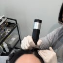 스칼프디자인센터 울산 smp 여성 남성 탈모 두피 밀도 보강 솔직후기