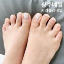 서리블리네일