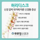 수성신경과 이미지