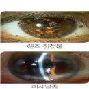 안경천국콘택트 이미지
