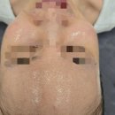 대전피부관리 쁨에스테틱 세심한케어