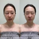 첨단기업1로 | 광주피부관리 첨단 에스테티아 이용 후기, 예비신부 윤곽관리 추천