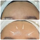 피부톡톡