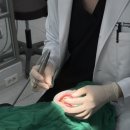 메이크치과의원 | 3D 가상 시뮬레이션 보고 결정한 메이크치과 라미네이트 후기 (수정 가능하다고요?)