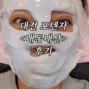 달 | 대전 유성 포텐자 &lt; 내돈내산 &gt; 1회 가격 / 시술과정 / 한달 후기