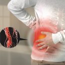 되지 생활건강 이미지