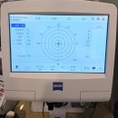 아이스퀘어안경 아차산점 | 광진구 중곡동 [아이스퀘어안경 아차산점]에서 고도수 안경 가공법
