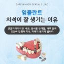 대구북구치과 임플란트 사후 관리가 중요한 이유