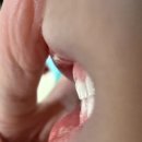 압구정민치과의원 네이버블로그