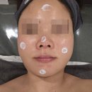 청주 탑동 에스테틱 , 예쁘지유에서 피부관리 받고 온 후기