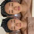 창원 상남동 얼굴 윤곽, 비대칭 관리; 손길에 반하다