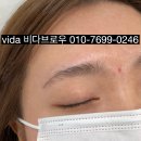 비다브로우