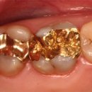 보성치과기공소 이미지