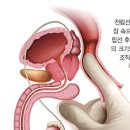 전립선 생긴 거 왜 항상 콩팥st지 싶어서 금색해봤는대 이미지