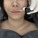 주정차단속-113 | [용봉동미용실] 머리 빠짐 고민하다가 찾은 헤드스파 다숨 체험 후기